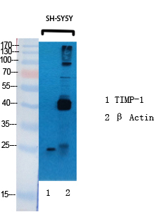 Rabbit Polyclonal Antibody to Metalloproteinase Inhibitor 1