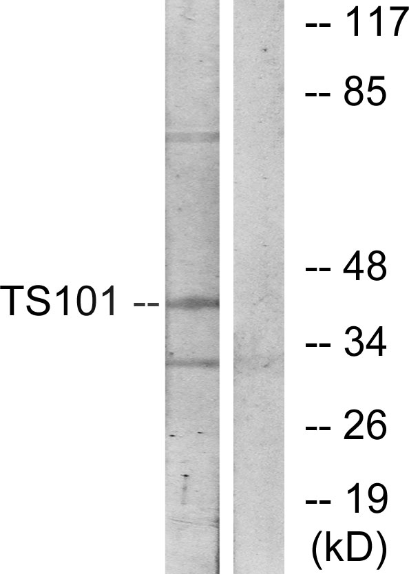 Rabbit Polyclonal Antibody to TSG101