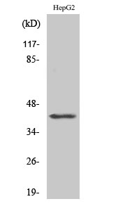 Rabbit Polyclonal Antibody to kappa Actin