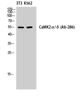 Rabbit Polyclonal Antibody to CaMKII alpha/delta