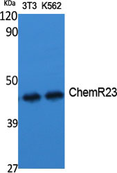 Rabbit Polyclonal Antibody to CMKLR1