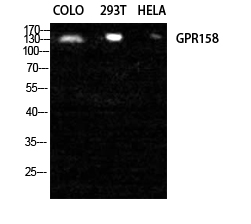 Rabbit Polyclonal Antibody to GPR158