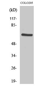 Rabbit Polyclonal Antibody to PDPK1