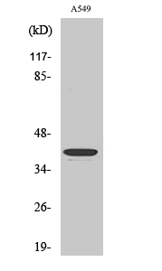 Rabbit Polyclonal Antibody to TACSTD2