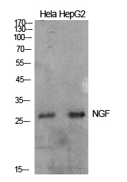 Rabbit Polyclonal Antibody to NGF