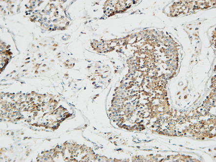 Rabbit Polyclonal Antibody to PTCH1