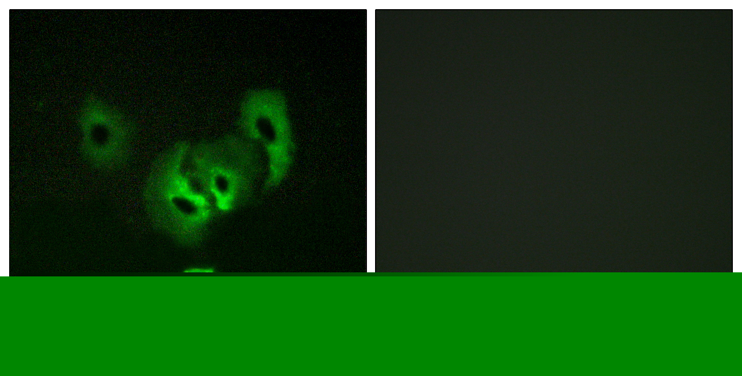 Rabbit Polyclonal Antibody to STEAP2