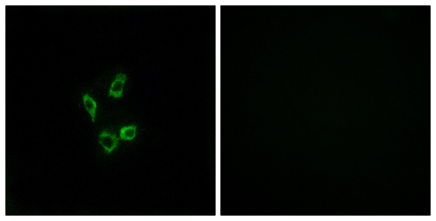 Rabbit Polyclonal Antibody to Cytochrome P450 4Z1