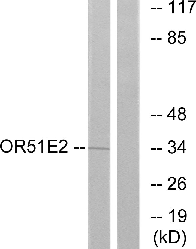 Rabbit Polyclonal Antibody to PSGR
