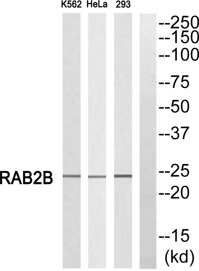 Rabbit Polyclonal Antibody to Rab2B