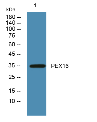 Rabbit Polyclonal Antibody to PEX16
