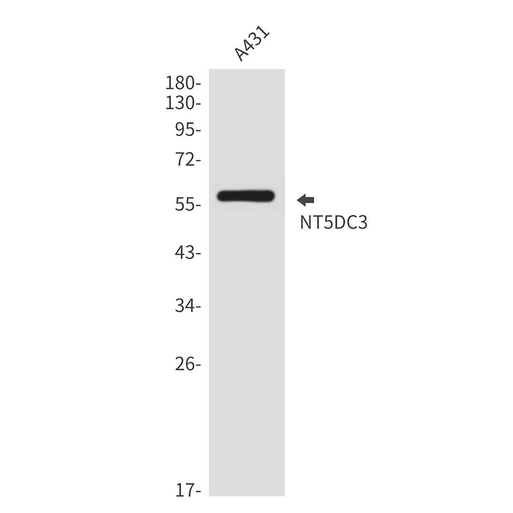 Rabbit Polyclonal Antibody to NT5DC3