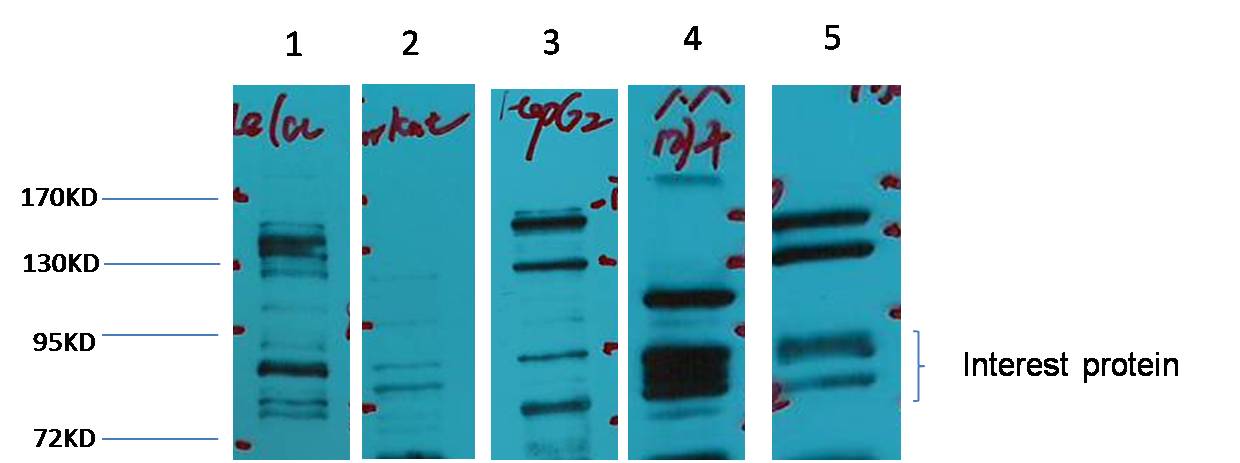 Rabbit Polyclonal Antibody to Glucocorticoid Receptor