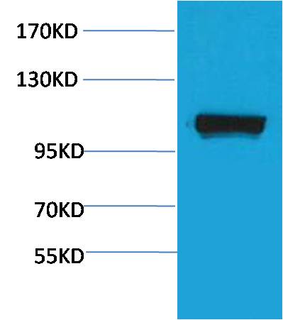 Rabbit Polyclonal Antibody to PEPC
