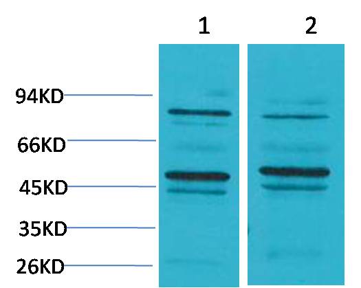 Rabbit Polyclonal Antibody to Bestrophin 2