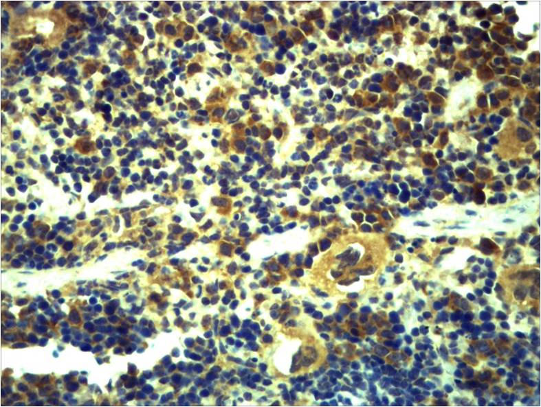 Rabbit Polyclonal Antibody to Toll-Like Receptor 6