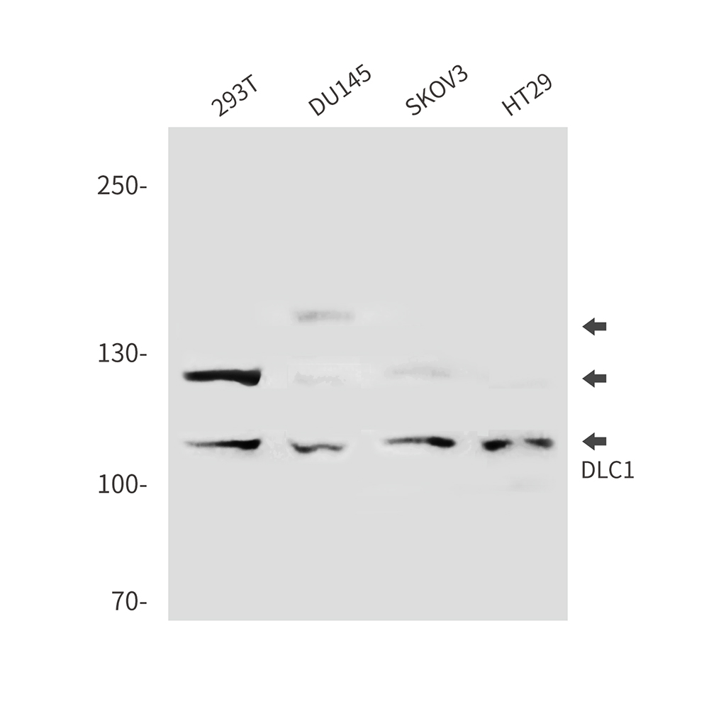 Rabbit Polyclonal Antibody to DLC1