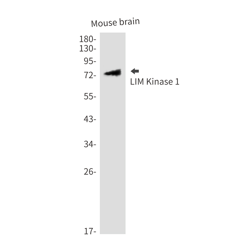 Rabbit Polyclonal Antibody to LIM Kinase 1