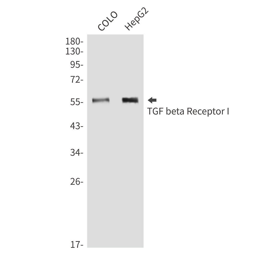 Rabbit Polyclonal Antibody to TGF beta Receptor I