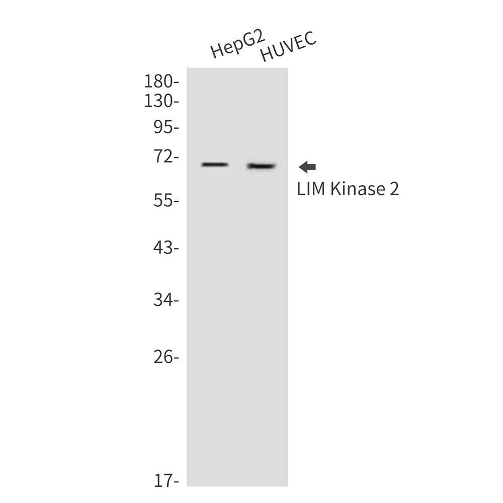 Rabbit Polyclonal Antibody to LIM Kinase 2