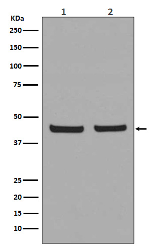 Rabbit Polyclonal Antibody to PHD1