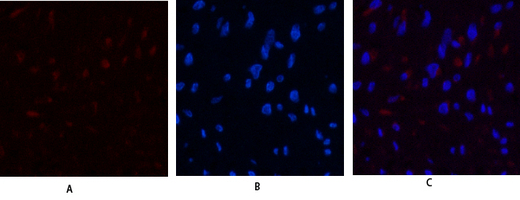 Rabbit Polyclonal Antibody to JAK3