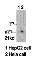 Rabbit Polyclonal Antibody to p21