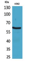 Rabbit Polyclonal Antibody to NOX2