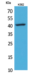 Rabbit Polyclonal Antibody to CD62L