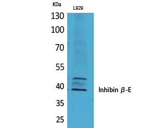 Rabbit Polyclonal Antibody to Inhibin beta E