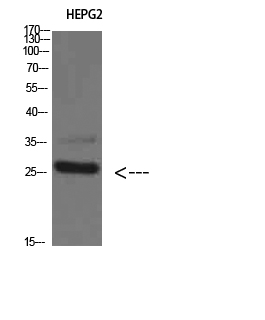 Rabbit Polyclonal Antibody to Tryptase delta