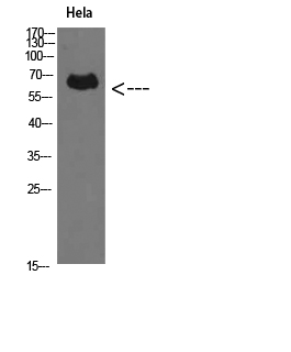 Rabbit Polyclonal Antibody to Perforin