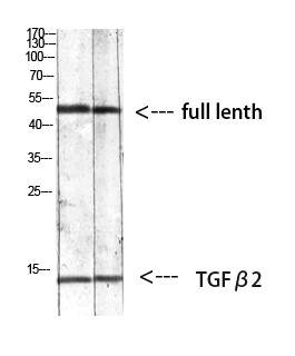 Rabbit Polyclonal Antibody to TGF beta 2