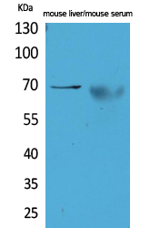 Rabbit Polyclonal Antibody to alpha 1 Fetoprotein