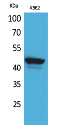 Rabbit Polyclonal Antibody to CD1E