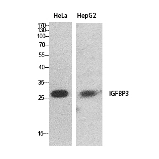 Rabbit Polyclonal Antibody to IGFBP3