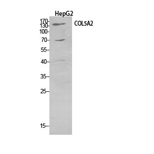 Rabbit Polyclonal Antibody to Collagen V alpha 2