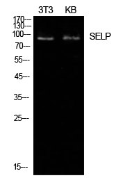 Rabbit Polyclonal Antibody to CD62P