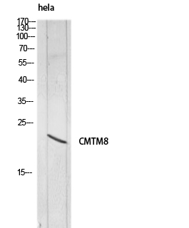Rabbit Polyclonal Antibody to CMTM8
