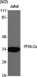 Rabbit Polyclonal Antibody to PP2A alpha