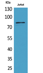 Rabbit Polyclonal Antibody to PREP