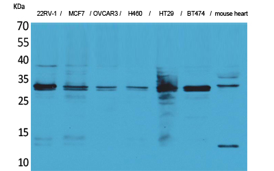 Rabbit Polyclonal Antibody to LXN