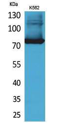 Rabbit Polyclonal Antibody to Transferrin