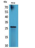 Rabbit Polyclonal Antibody to RNA Polymerase III Subunit C7