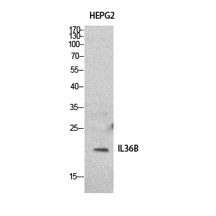 Rabbit Polyclonal Antibody to IL-36 beta