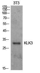 Rabbit Polyclonal Antibody to Prostate Specific Antigen