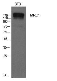 Rabbit Polyclonal Antibody to Mannose Receptor