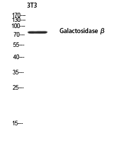 Rabbit Polyclonal Antibody to GLB1