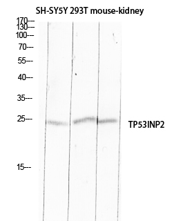 Rabbit Polyclonal Antibody to TP53INP2