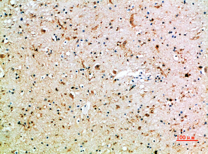 Rabbit Polyclonal Antibody to CD16